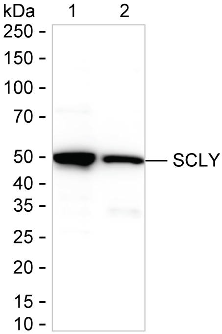 Various cell lyastes were run on 6-18% SDS-PAGE under reducing conditions and blotted onto nitrocellulose membrane. SCLY Antibody (Clone # K2K046_1E2) with a dilution ratio of 1 μg/ml was used as the primary antibody and DH-083 at a dilution of 1:2000 was used as the secondary antibody. SCLY band was visualized using ECL Western Blotting Substrate. Lane 1: 15 μg of THP-1 lysate Lane 2: 15 μg of MCF-7 lysate Result: DH-083 can be used as the secondary antibody in Western blotting.